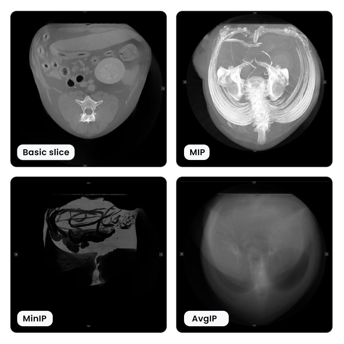 Thick slab rendering modes